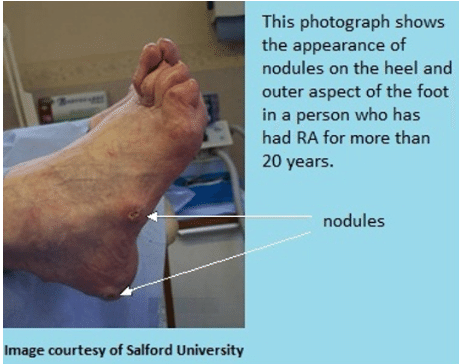足と足首の手術　Surgery of the foot and ankle 2冊 足と足首の手術 Surgery of the foot and ankle 2冊