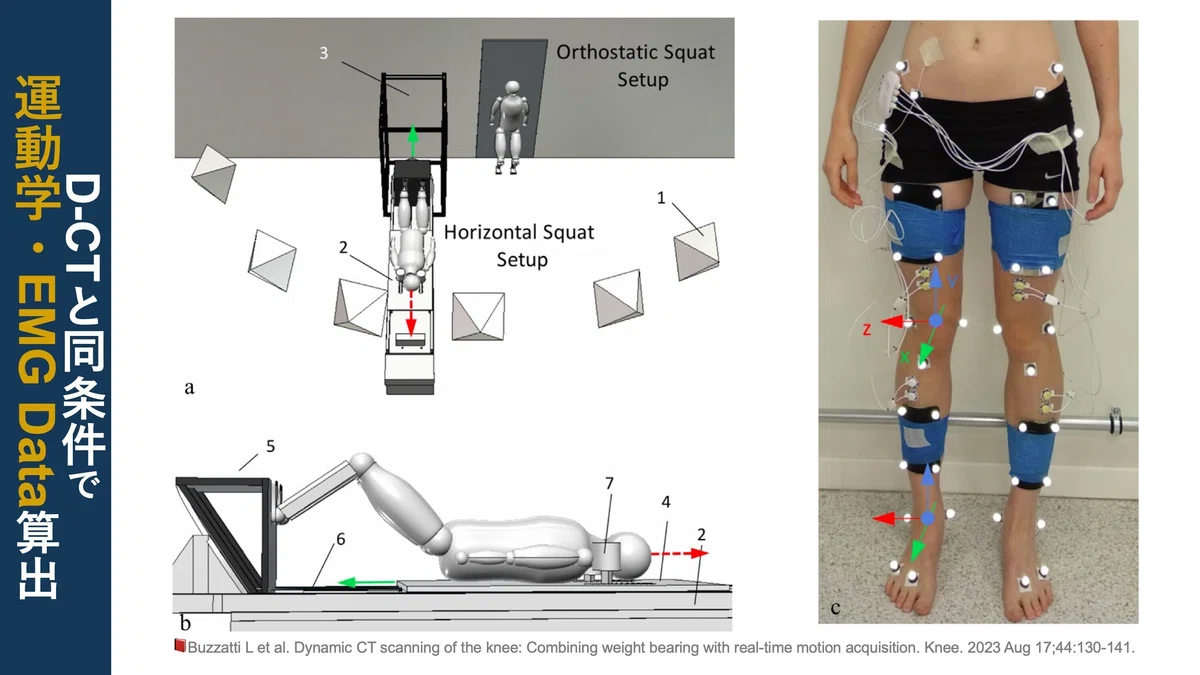 Dynamic CT。動作中の関節動態を把握｜Super Human | 理学療法士／保健学博士 Ph.D.