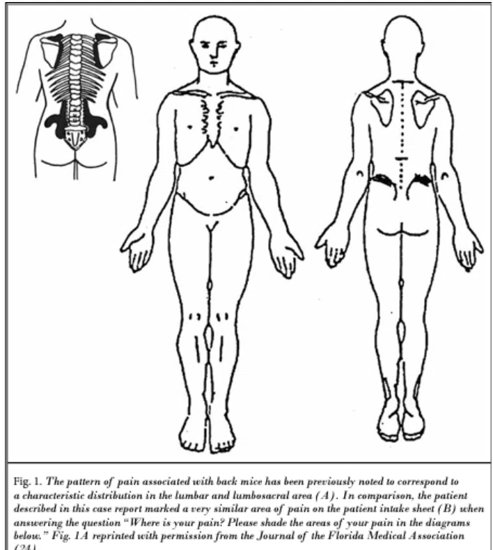 50章 腰の痛み Low Back Pain｜KEN