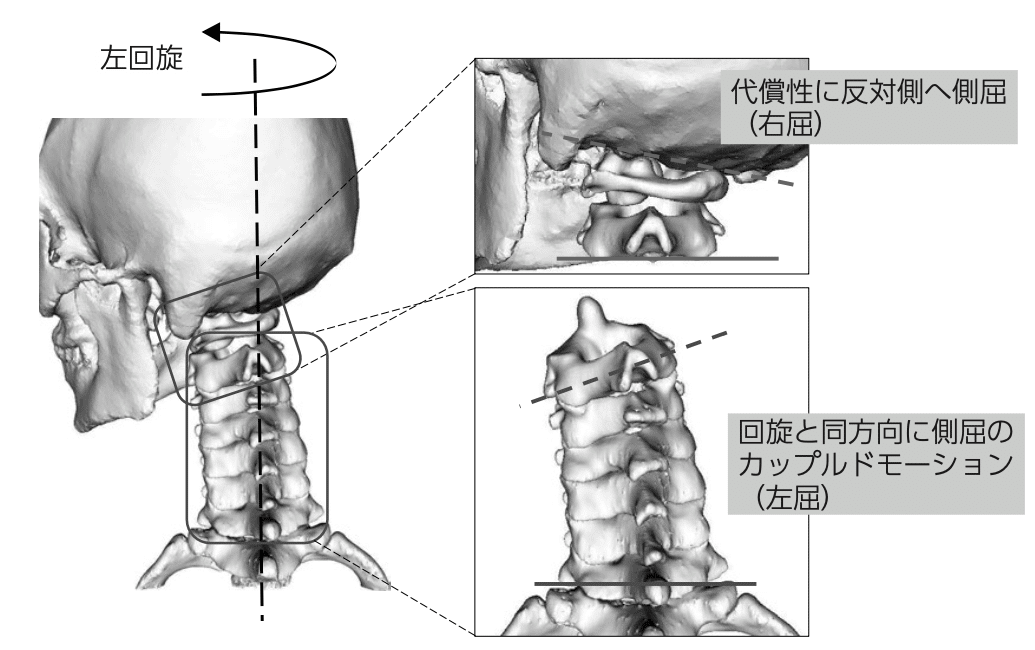 頸部を屈曲すると頸部背側から上肢に症状が出現する患者の評価 ・ 治療の実際 頸部痛の整形外科テスト〜頸椎ストレステスト・緩和テスト、椎骨