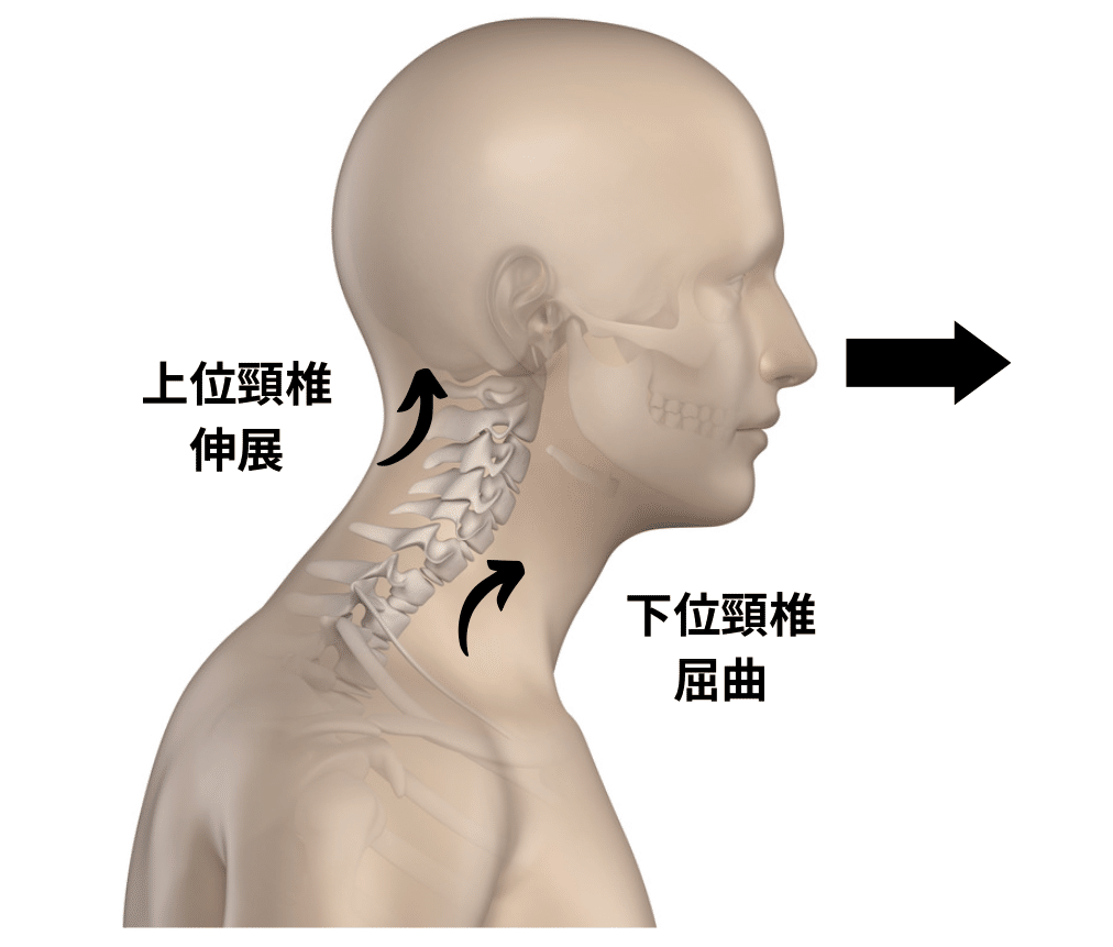 PNFの治療技術 ： 臨床応用編 ３「 頸椎へのアプローチ 」【全２巻】 PNFの治療技術 ： 臨床応用編 3「 頸椎へのアプローチ 」【全2