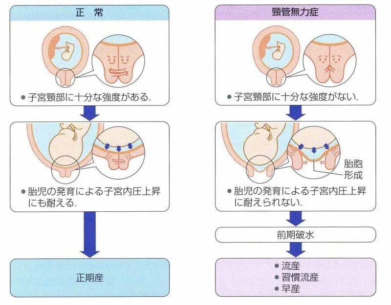 「母性看護学」まとめ|やふぃあ