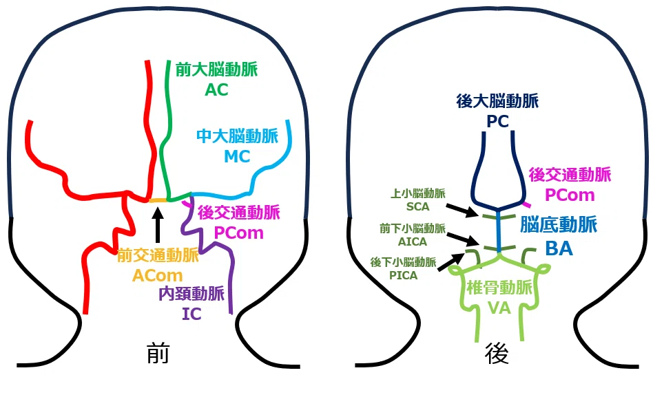保存版】脳の血管の略語～IC-PC動脈瘤とは？～｜脳プロブレム