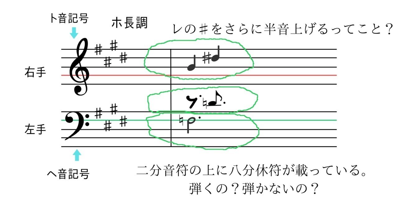 誰でもピアノソナタが書けちゃいます《番外編》【臨時記号？・2段の