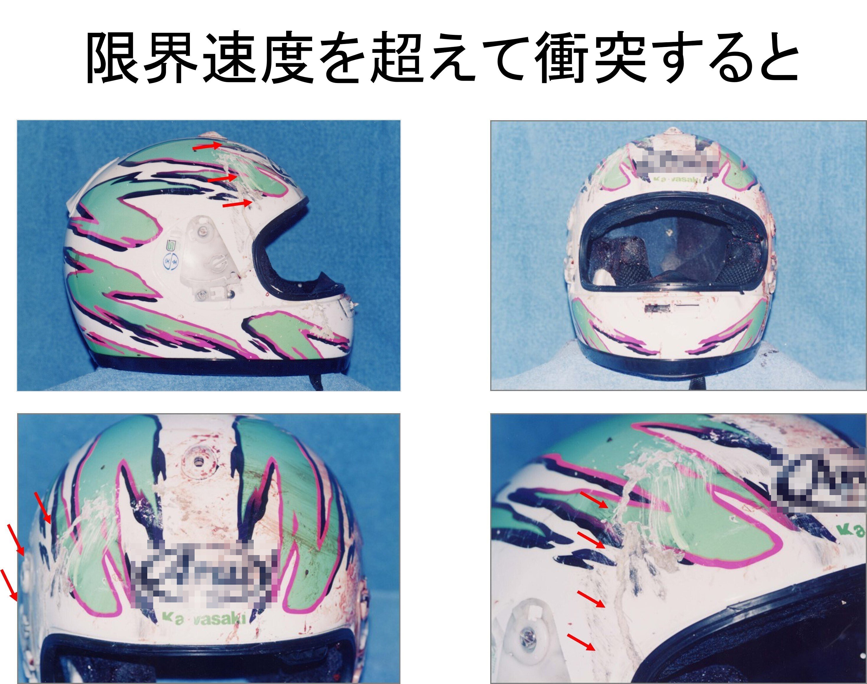 第1回】なぜ、ヘルメットを被るのか？｜へるす出版