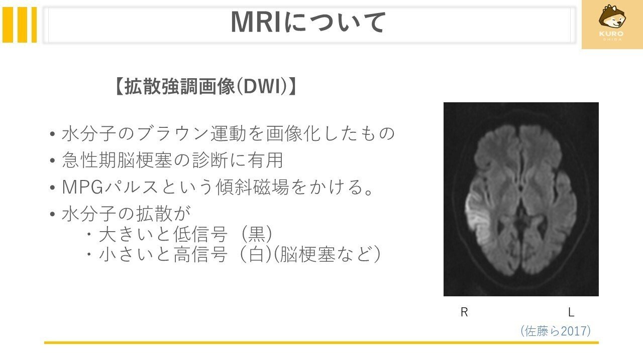 拡散テンソル法による ヒト脳白質のMRIアトラス~MRI Atlas of