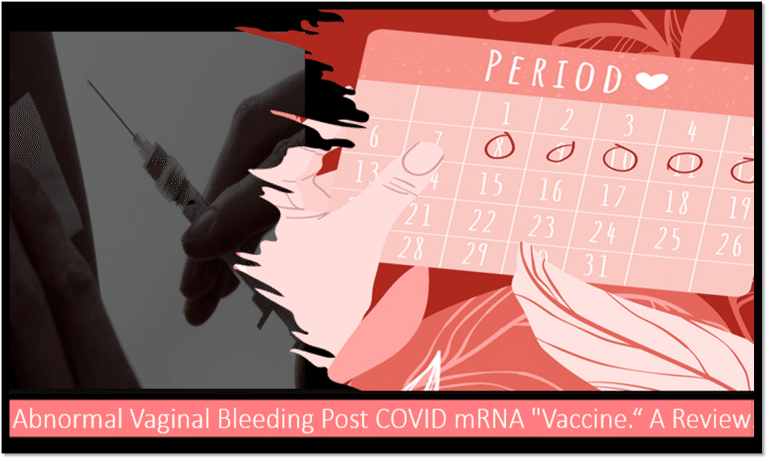 最も一般的なタイプの膣感染症