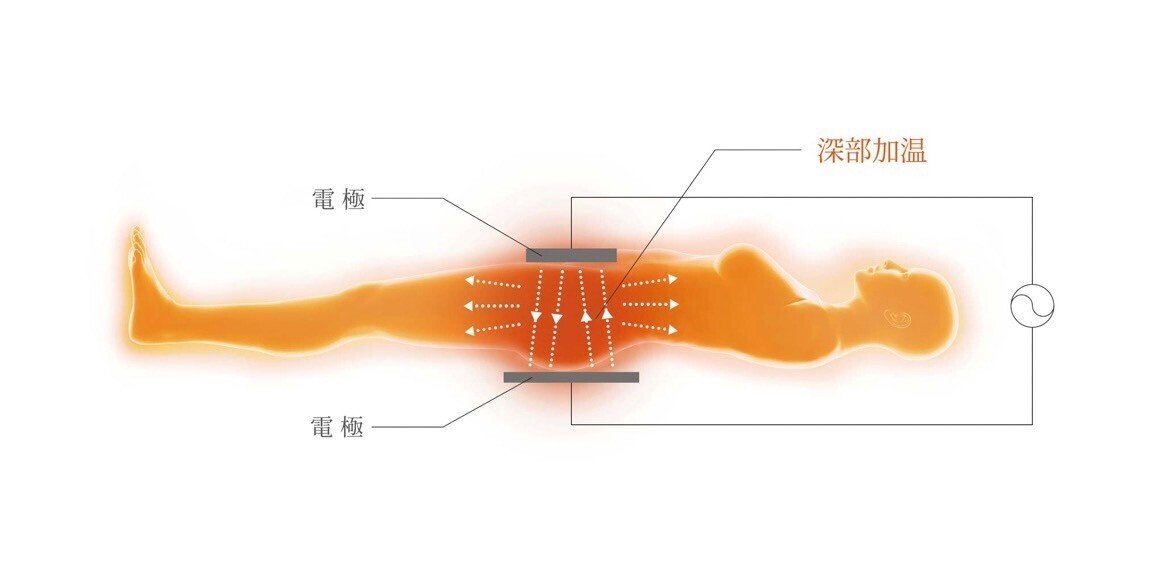 温まるのが速い！インディバ導入したい方必見★業務用速攻痩身機器448khz 温まるのが速い！インディバ導入したい方必見☆業務用速攻痩身機器