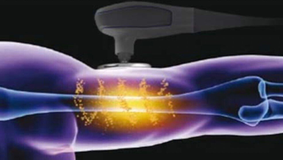 インディバ®（INDIBA®）」とは❓｜select salon GARDEN まついあきこ