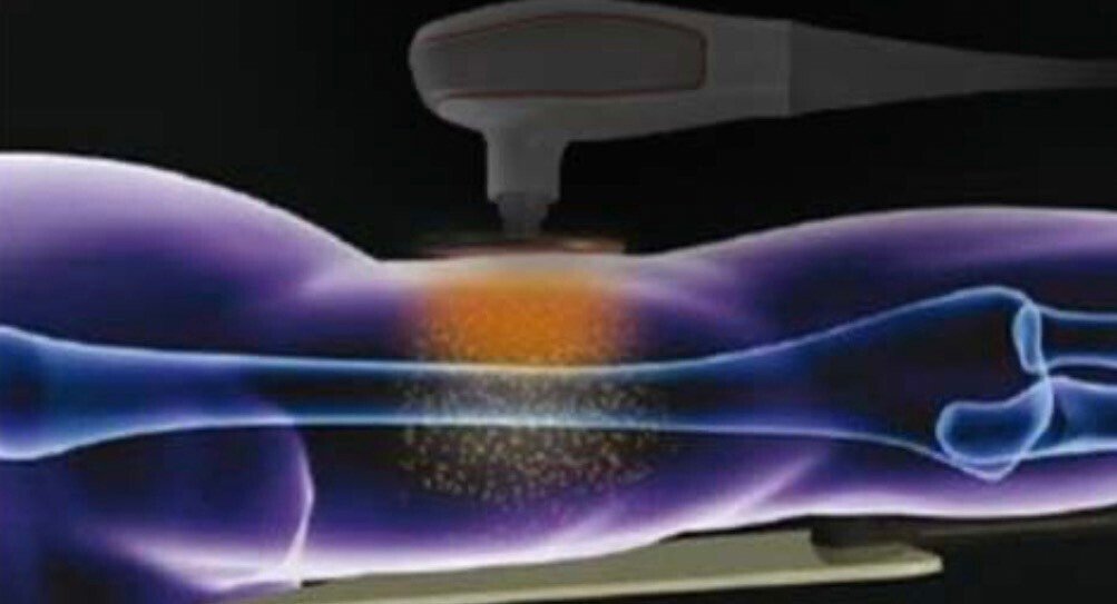 インディバ®（INDIBA®）」とは❓｜select salon GARDEN まついあきこ