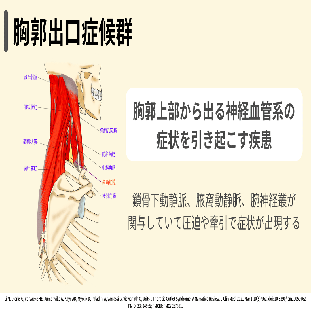 これだけは知ってほしい胸郭出口症候群｜小林龍樹＠理学療法士