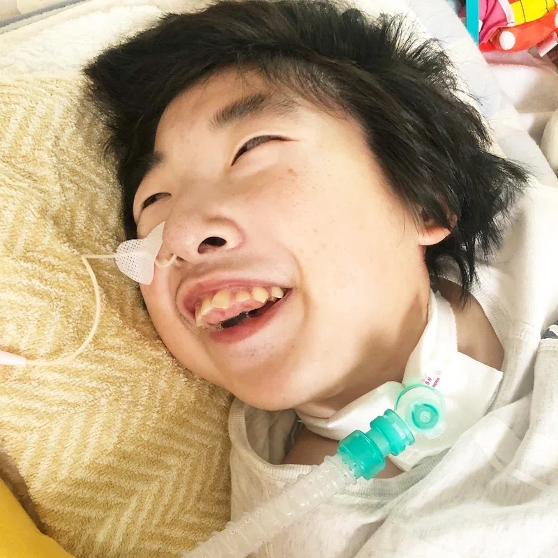 脳性まひのさまざまな特性について①｜CP smiles