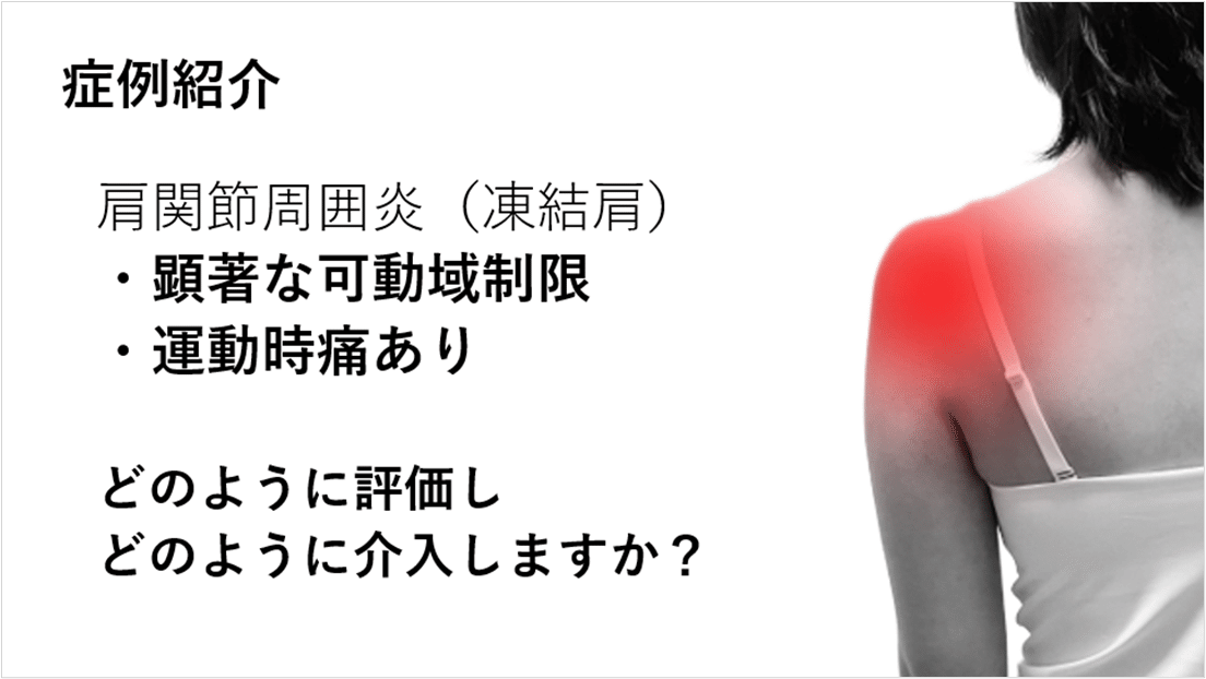 症例から学ぶ肩関節可動域制限 ～拘縮肩・腱板損傷の可動域を拡大させる！～｜Y.K