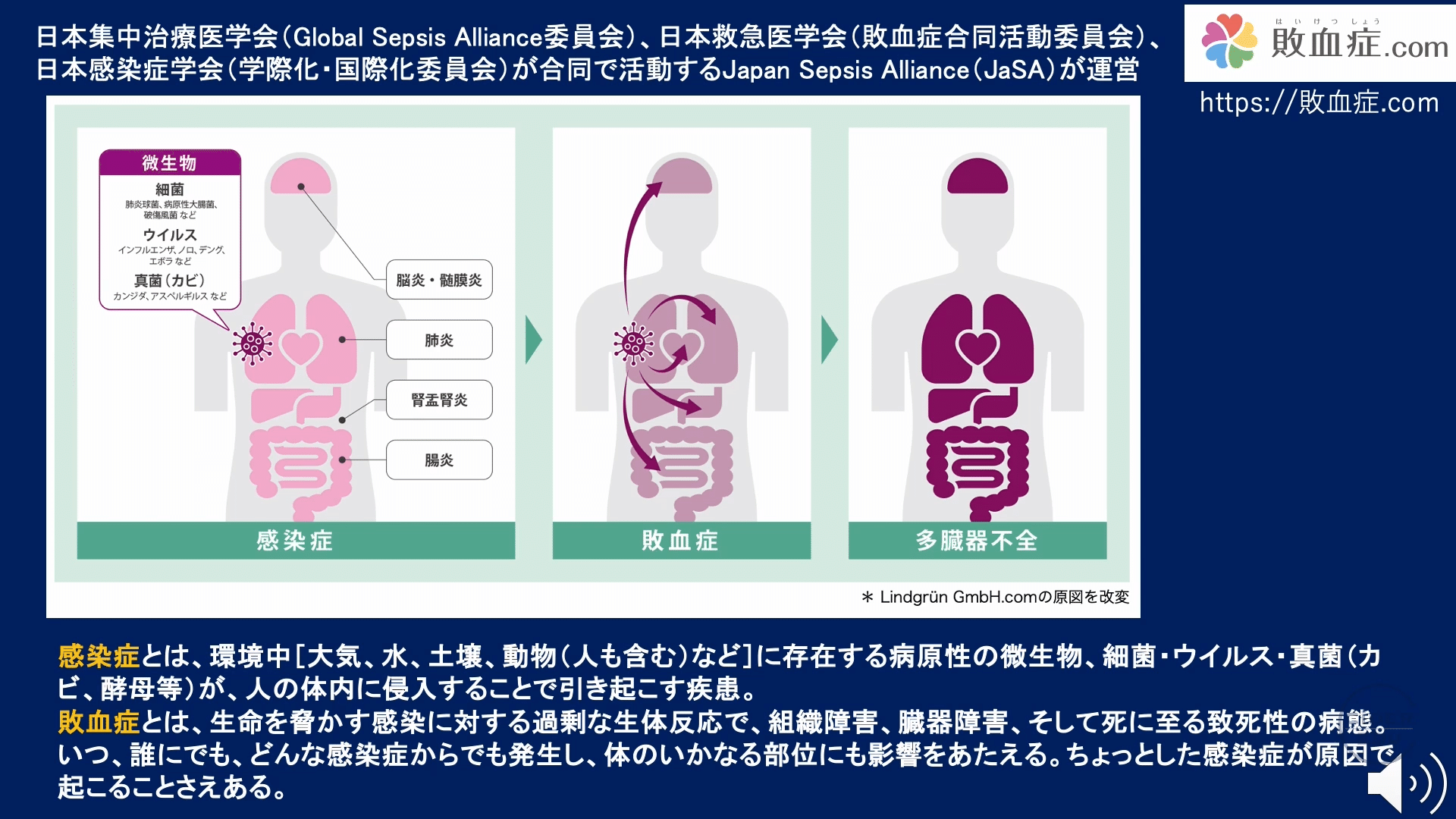 CORE-ID 2022 第19回「敗血症」を公開しました｜CiDER-EDU【公式】