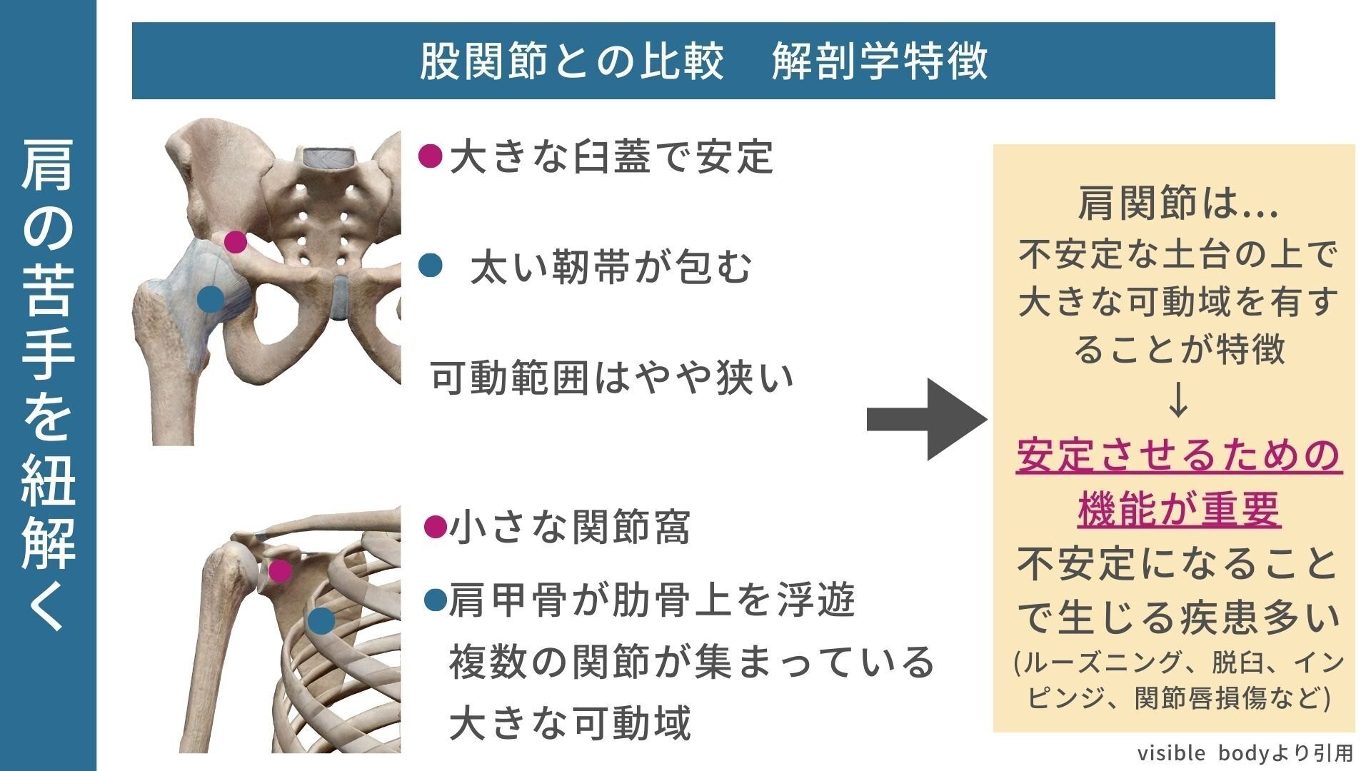 肩関節外科の要点と盲点　裁断済み 肩関節手術のすべて | 菅谷 啓之, 秋田 恵一(編集協力), 二村 昭元