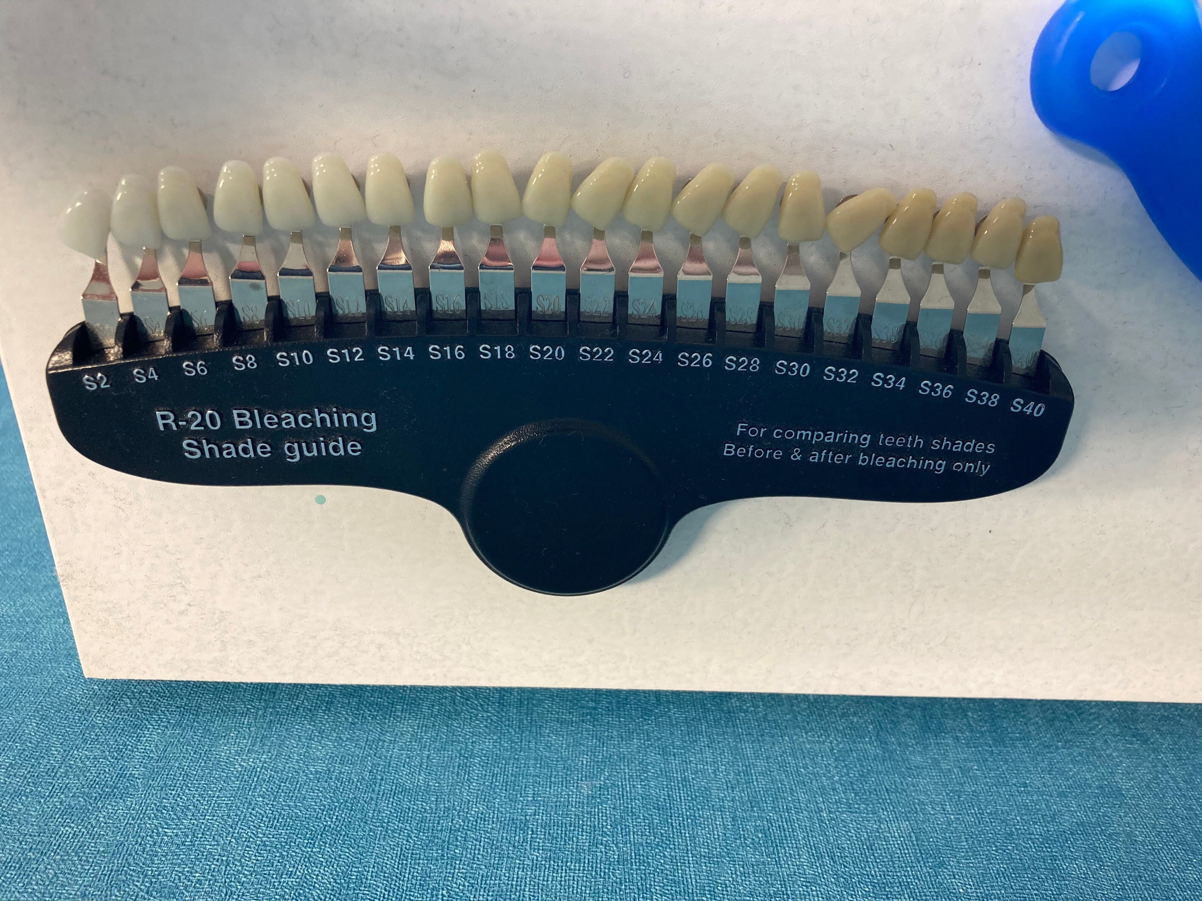 61 セルフホワイトニング4回の結果｜ジセおじ GAMI