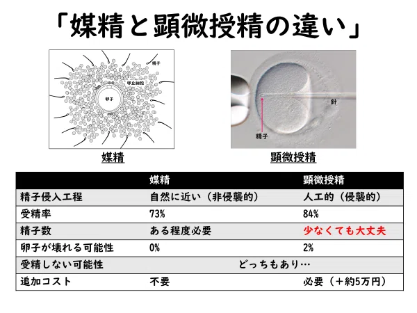 海外で体外受精:ICSI(顕微授精)する?しない?|43歳@海外体外受精中