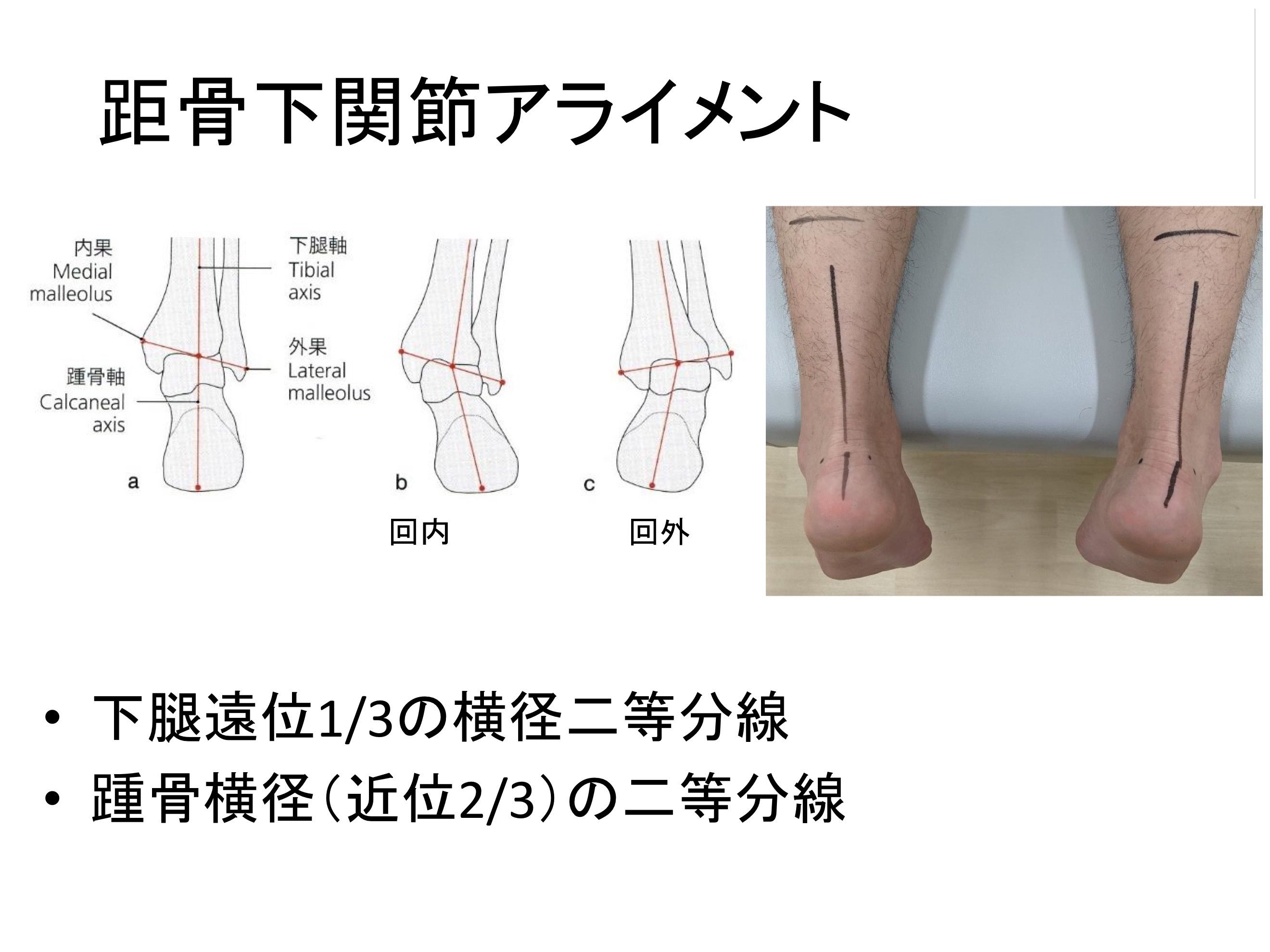 足部・足関節の評価と治療 足部・足関節の評価と治療～足関節捻挫を中心とした足部疾患の