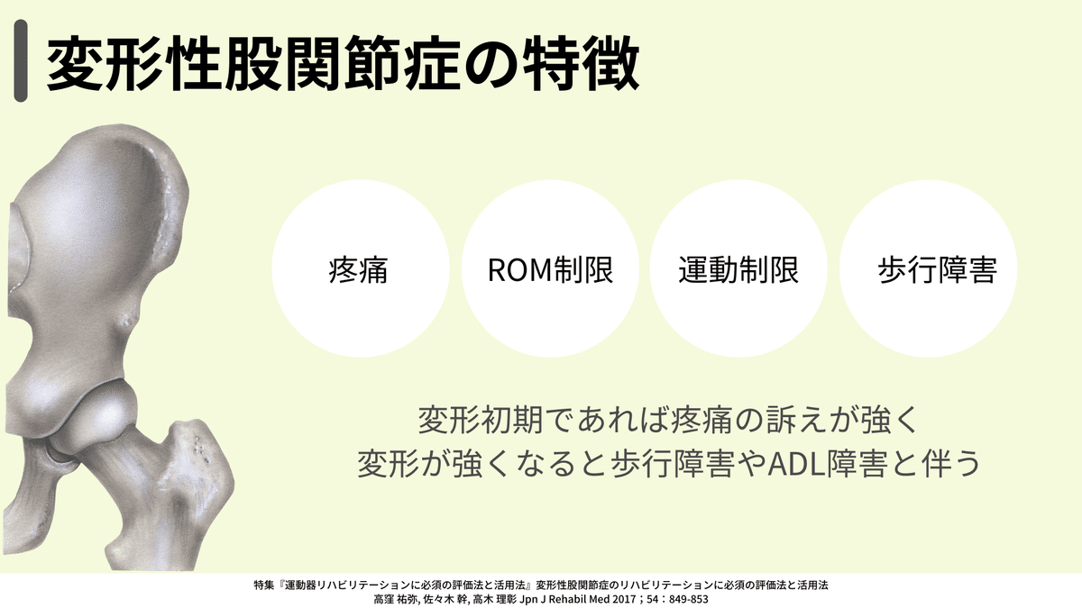 変形性股関節症患者の特徴｜小林龍樹＠理学療法士