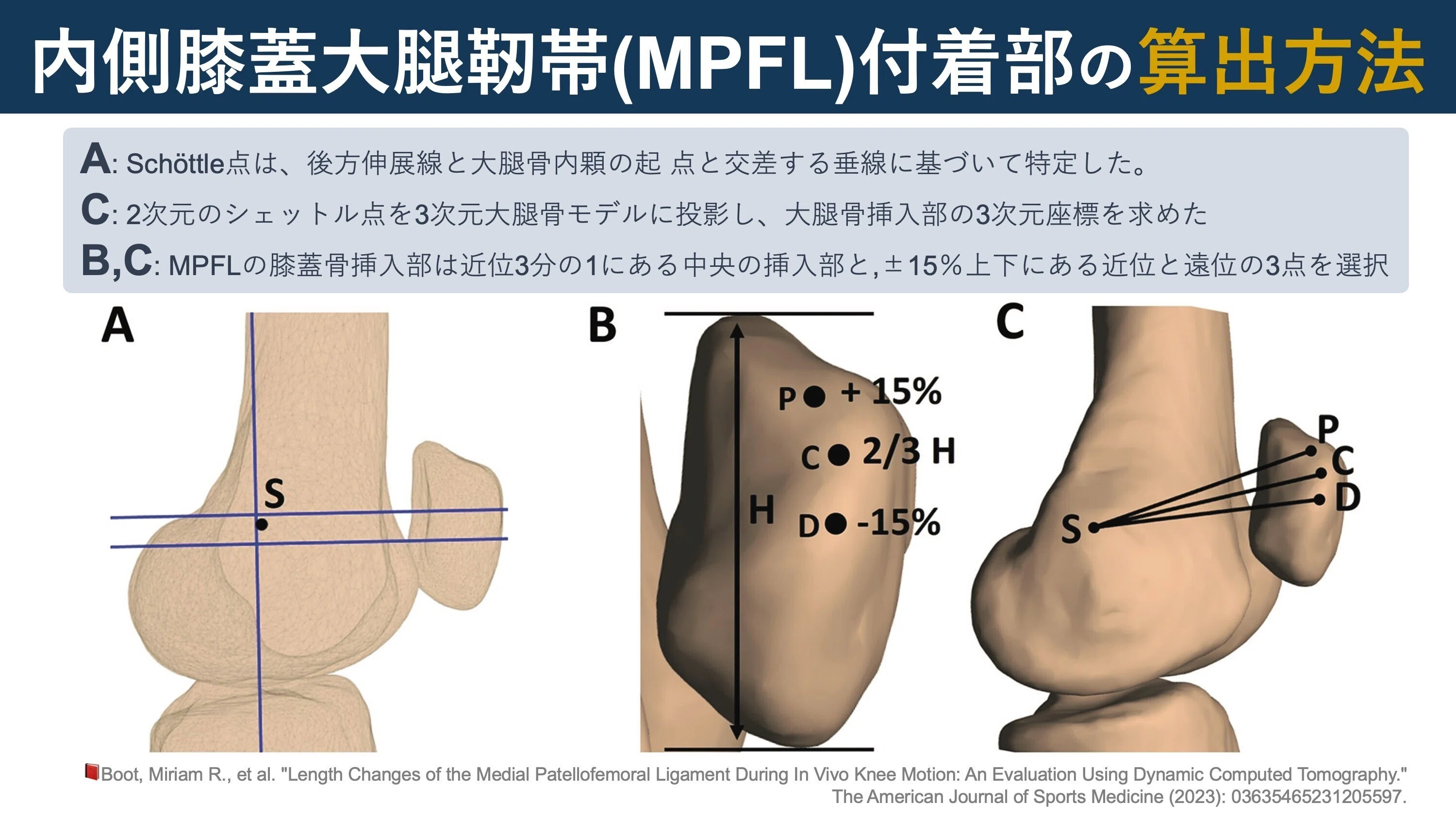内側膝蓋大腿靭帯の運動学｜Super Human | 理学療法士／保健学博士 Ph.D.