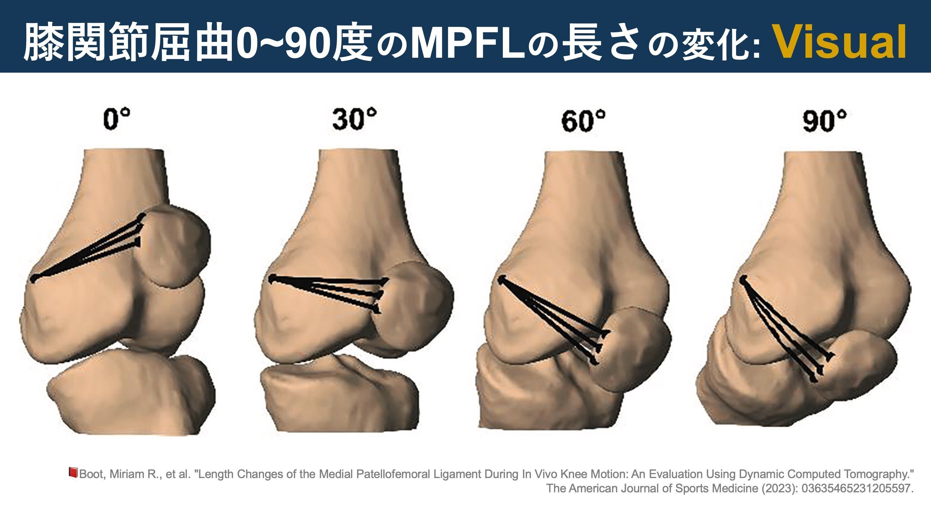 レア絶版初版本函付膝形態・機能と靭帯再建術W.ミュラー新名正由訳