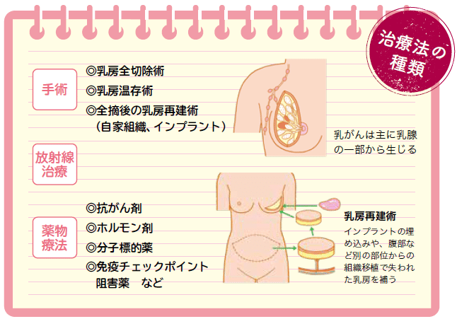 遺伝や女性ホルモンの影響も発症リスクに 乳がん｜医療新聞社