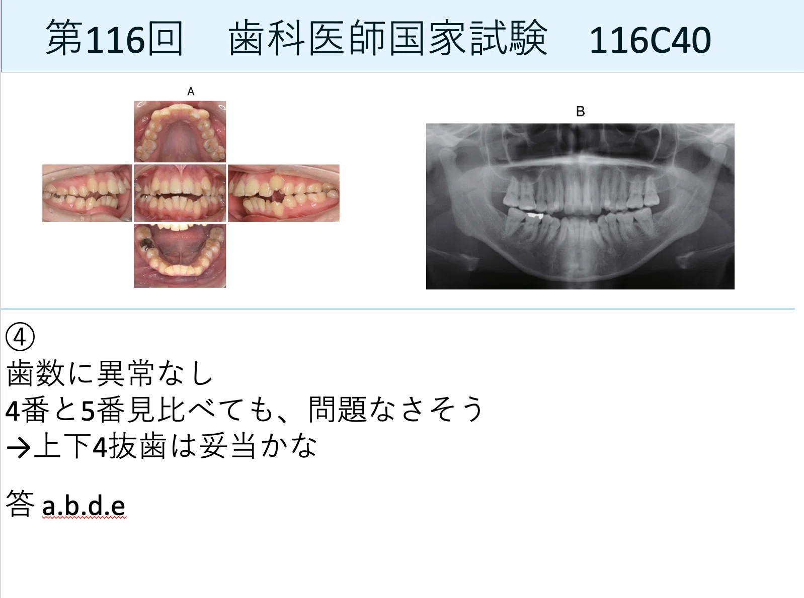歯科医師国家試験 臨床問題の解き方！｜Shikagorori