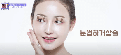 韓国整形　美容外科　渡韓整形　目整形　二重整形　まつ毛パーマ