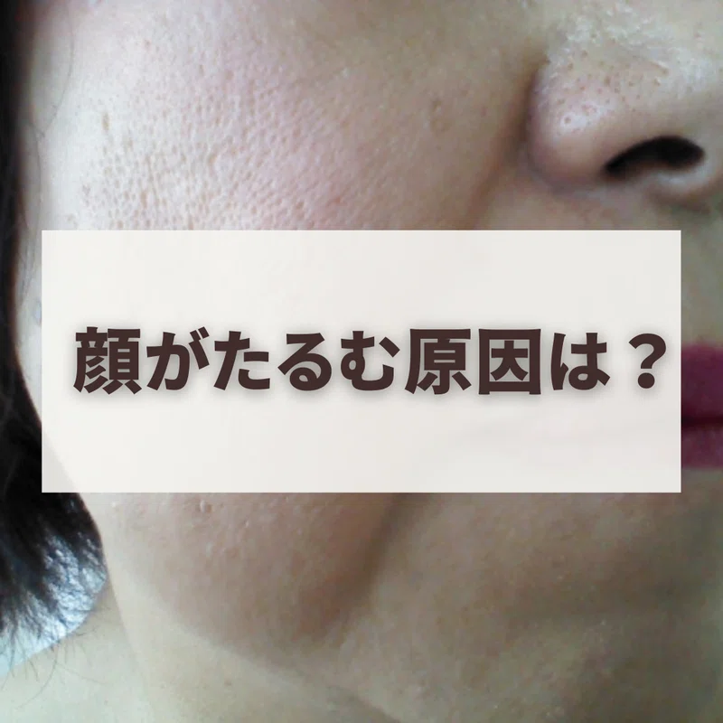 顔がたるむ原因は？｜山崎将 ワイズジム代表トレーナー