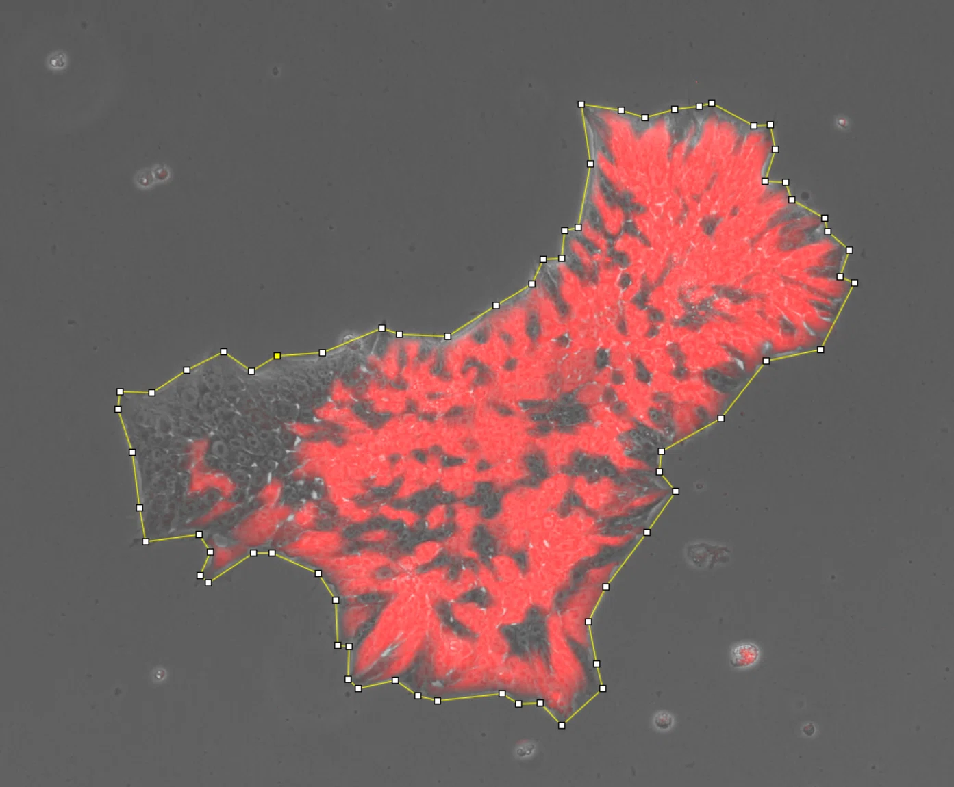 imageJ】指定範囲内の蛍光面積を測定したい｜ぶるーく