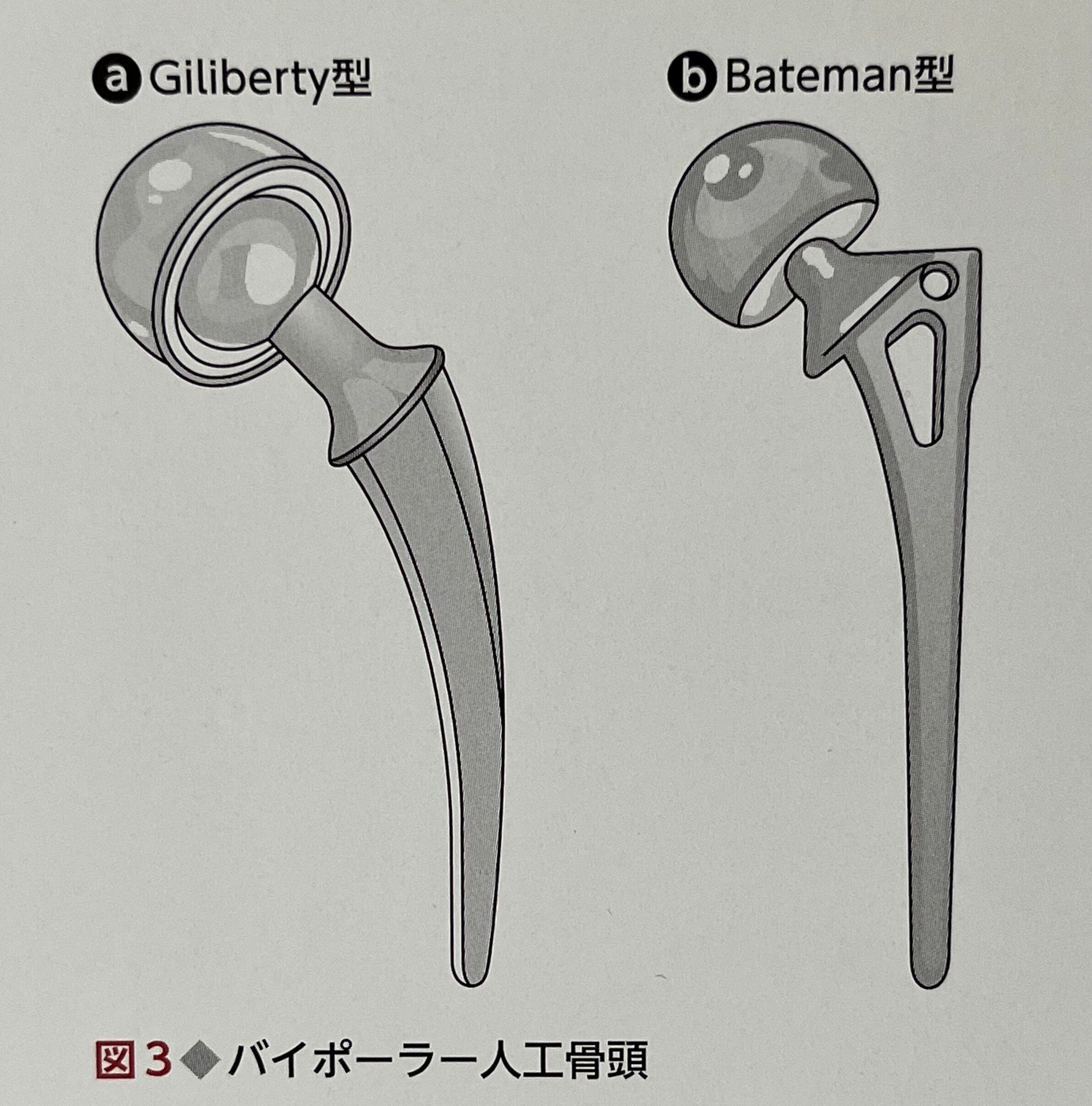 BHA・THA 人工股関節置換術パーフェクト BHA・THA 人工股関節置換術