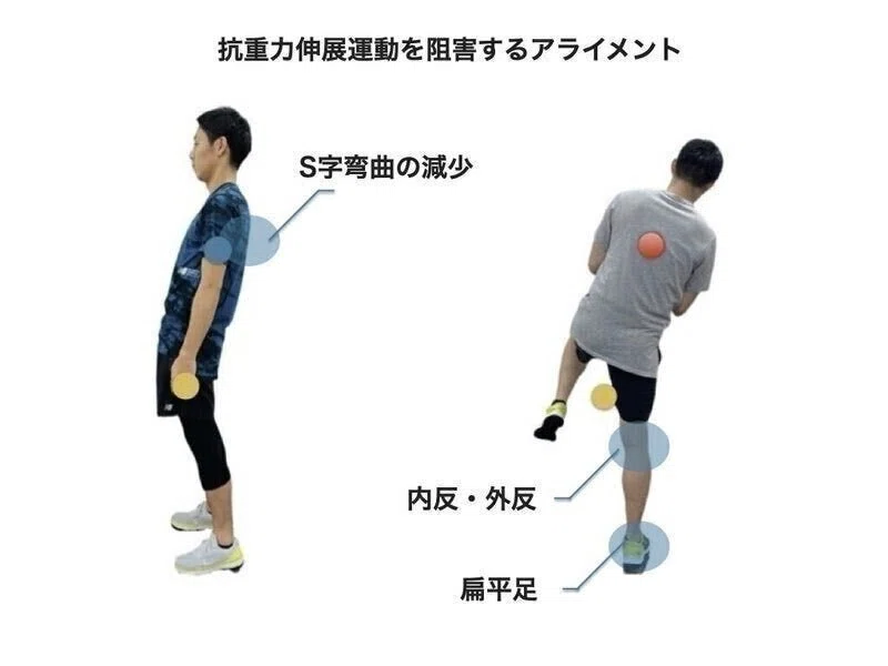 姿勢制御能力改善のための姿勢改善エクササイズ｜平 純一朗｜理学療法