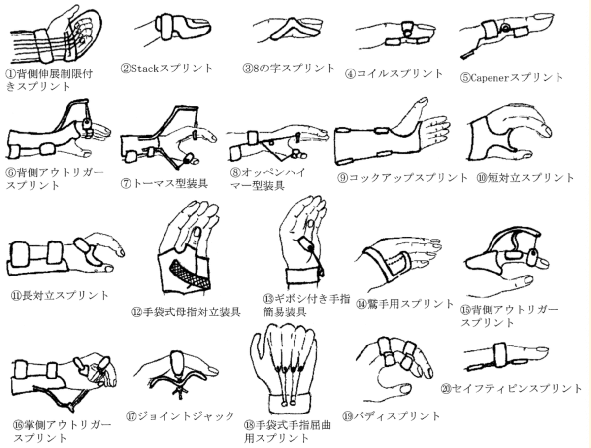 ハンドスプリント 作り方用い方 ハンドセラピィにおけるコイルスプリントの作成方法と準備物