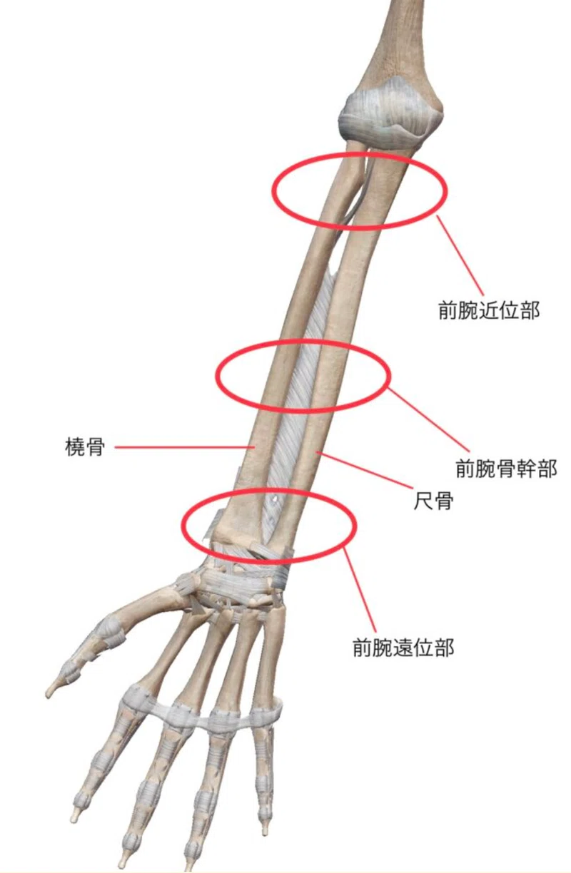 橈骨遠位端骨折(Distal radius fracture：DRF)｜あひるOT