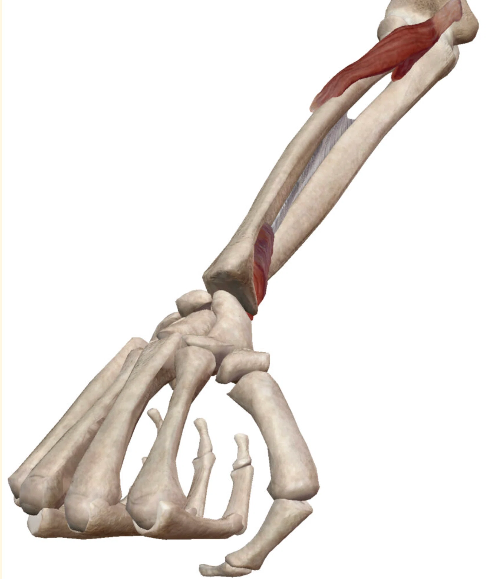 橈骨遠位端骨折(Distal radius fracture：DRF)｜あひるOT