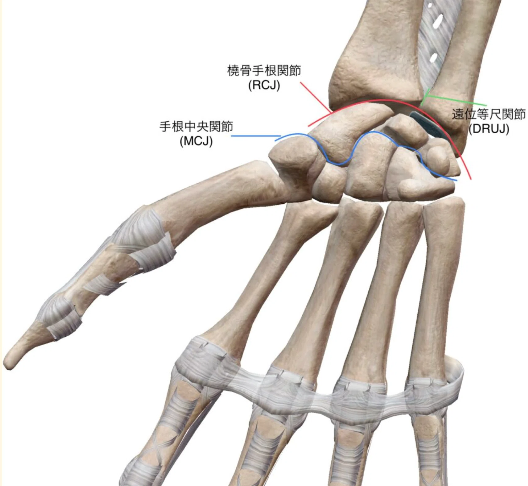 橈骨遠位端骨折(Distal radius fracture：DRF)｜あひるOT