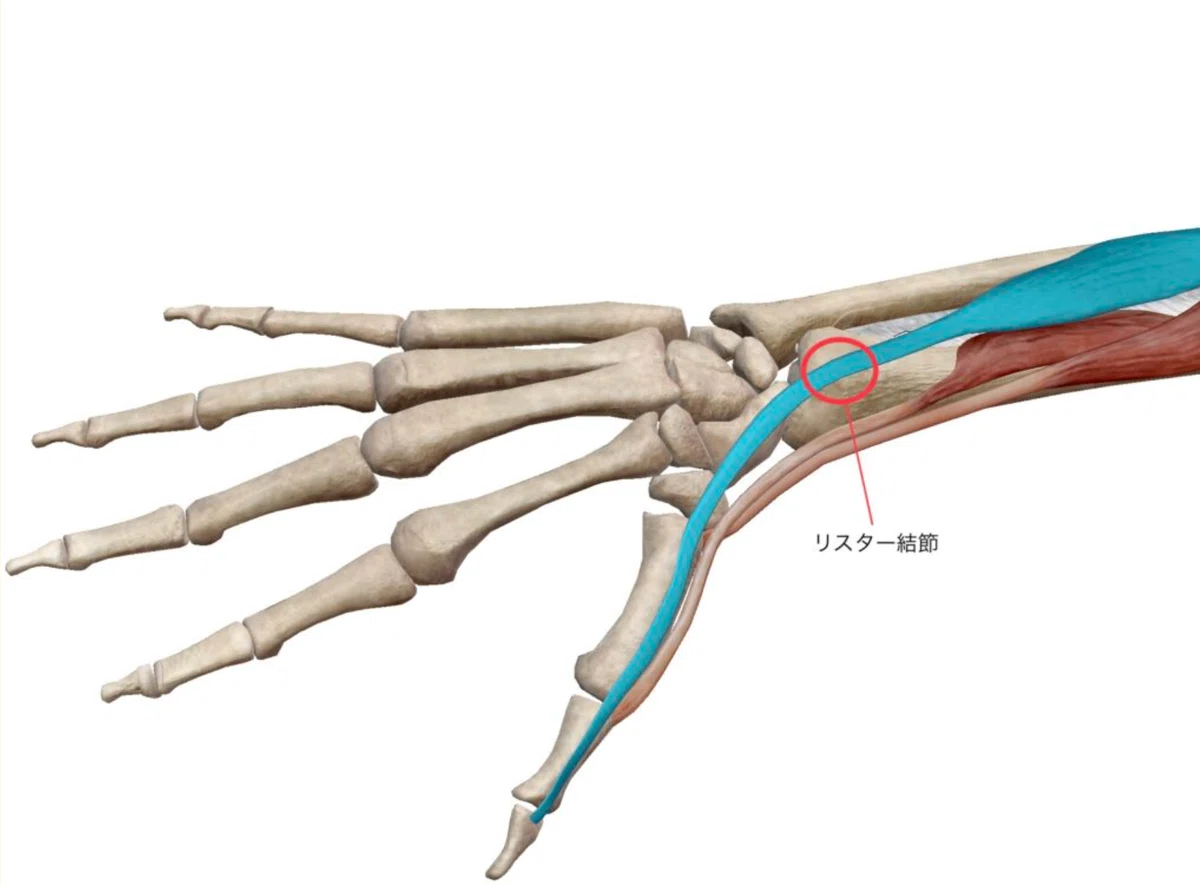 橈骨遠位端骨折(Distal radius fracture：DRF)｜あひるOT