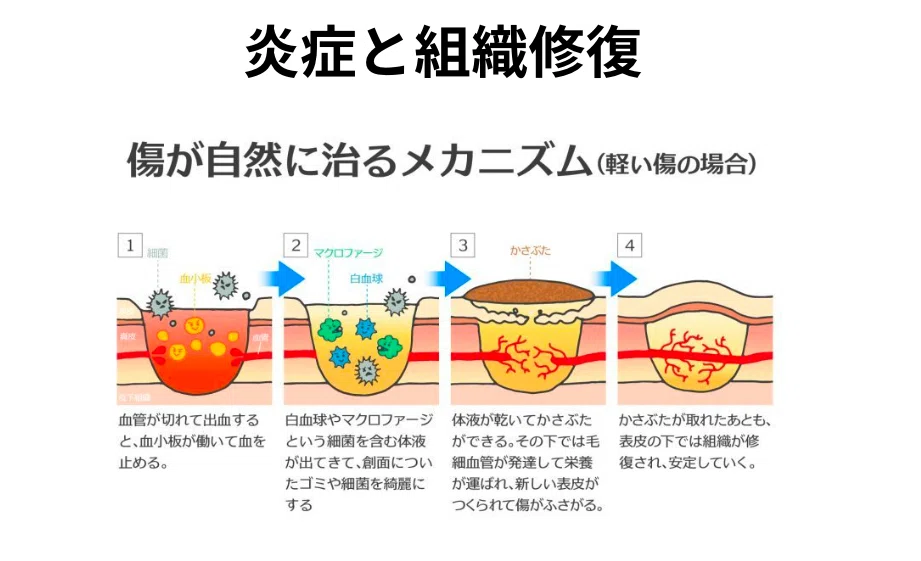 組織修復の3つのフェーズ（炎症期・増殖期・リモデリング期）の時間経過を示す図