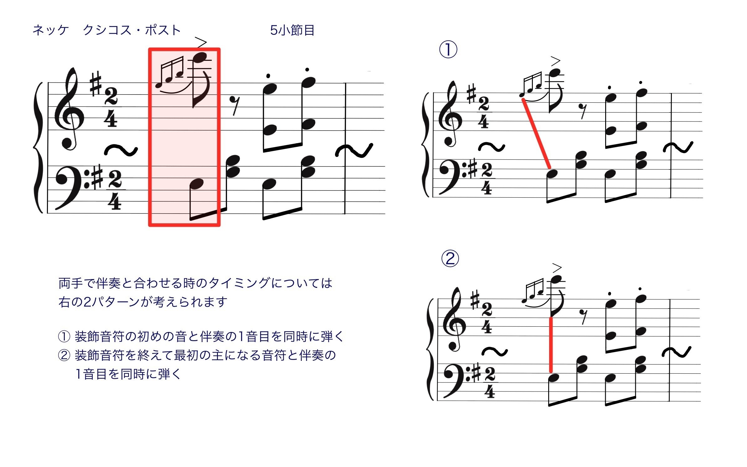 正しい装飾音奏法 | フレデリック ノイマン, Neumann,Frederick