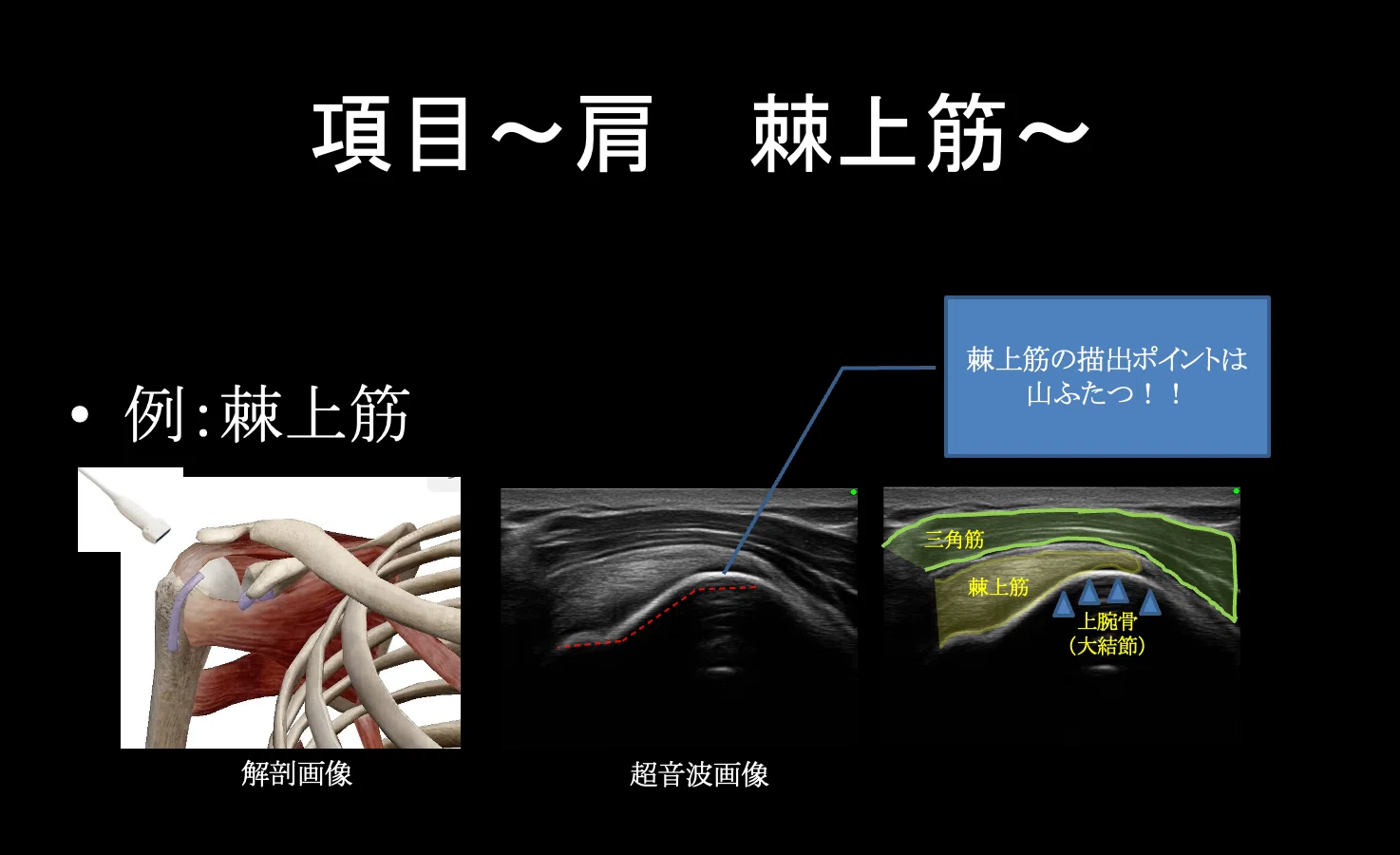 超音波診断装置を使った病態把握｜こばさん（小林由弥）