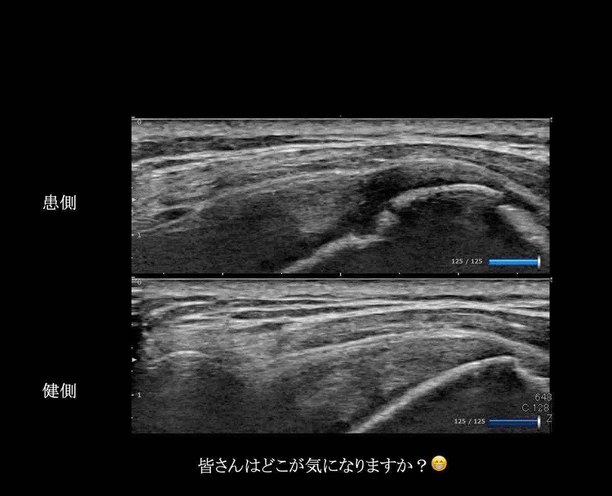 超音波診断装置を使った病態把握|こばさん(小林由弥)