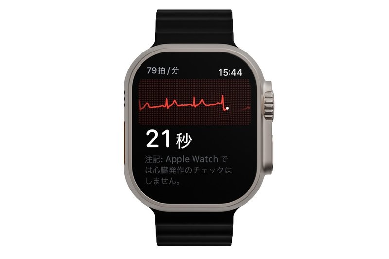 Apple Watchの心電図（ECG）の測定
