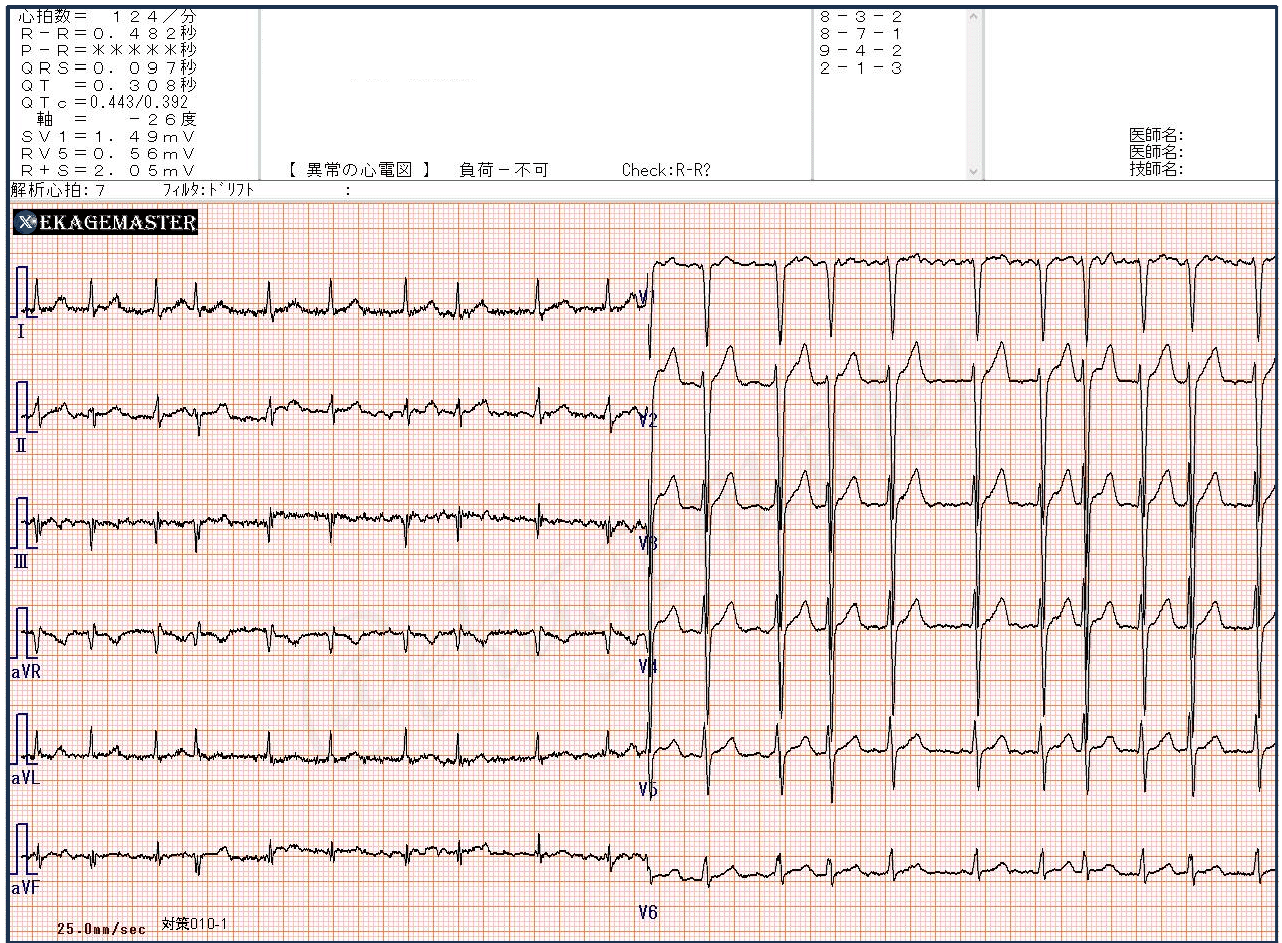 心電図検定対策7点セット