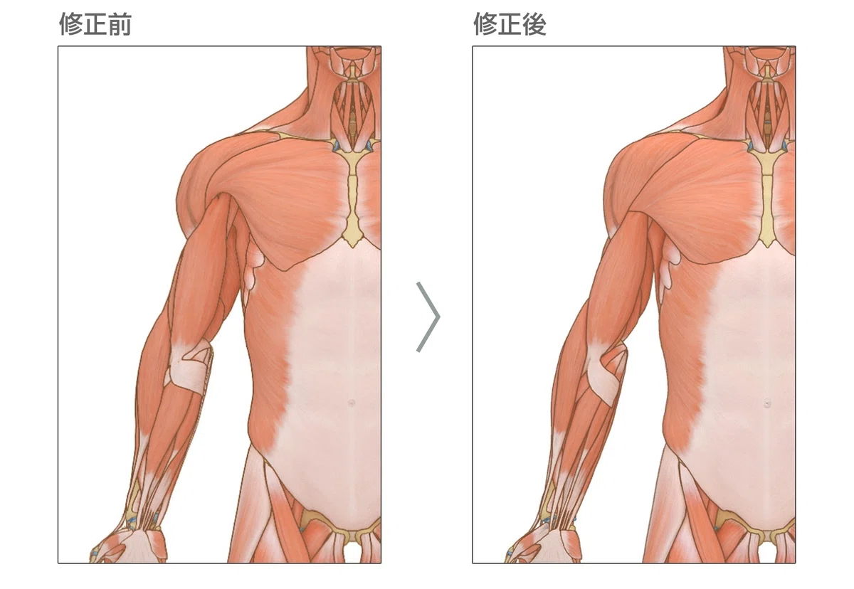 病気がみえるvol.11』の特典CGコンテンツを制作しました｜MIG 