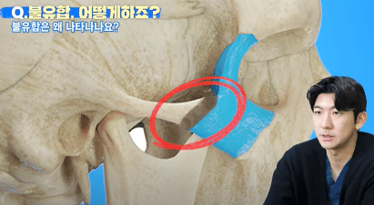 韓国整形　韓国美容外科　渡韓整形　輪郭整形　美容整形