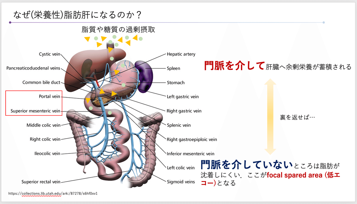 限局的に脂肪がついたりつかなかったりする肝臓の話 ｜ミケ