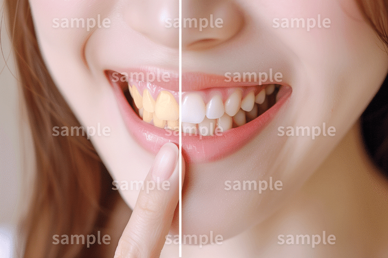 【ビフォー＆アフター】「ホワイトニング女性」のフリー素材｜歯科・広告・ホームページのイメージ画像に