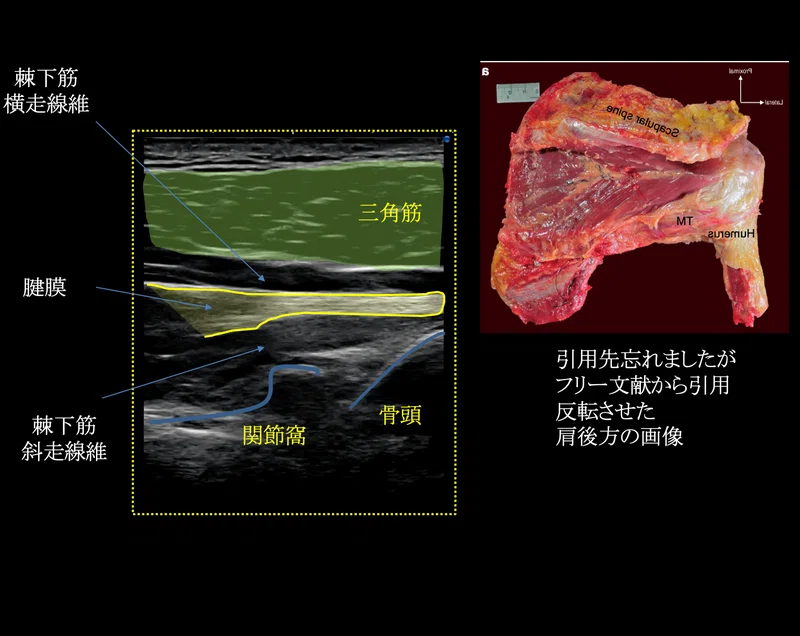 超音波診断装置を使った病態把握｜こばさん（小林由弥）