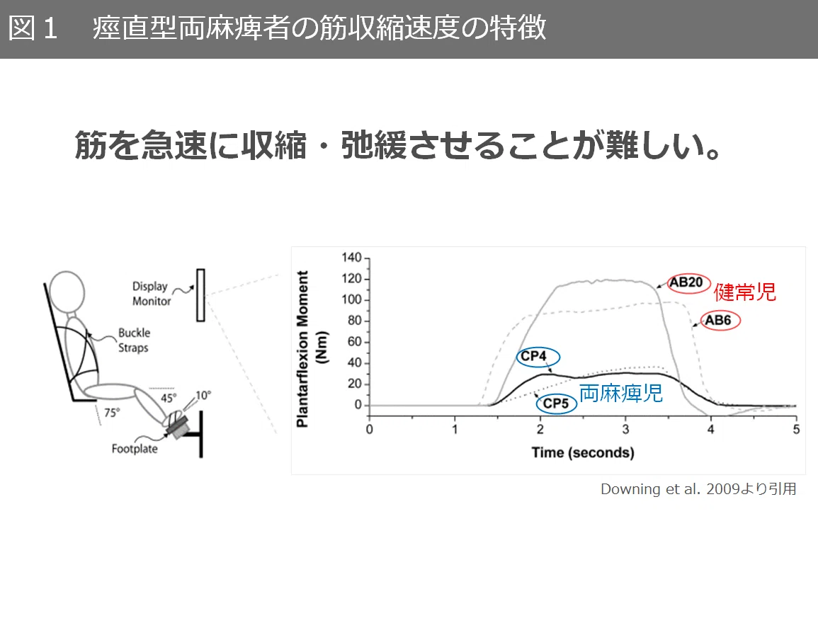 痙直型脳性麻痺: 筋機能に焦点を当てた歩行能力向上の新戦略｜だいすけ｜小児リハ×発達×教育