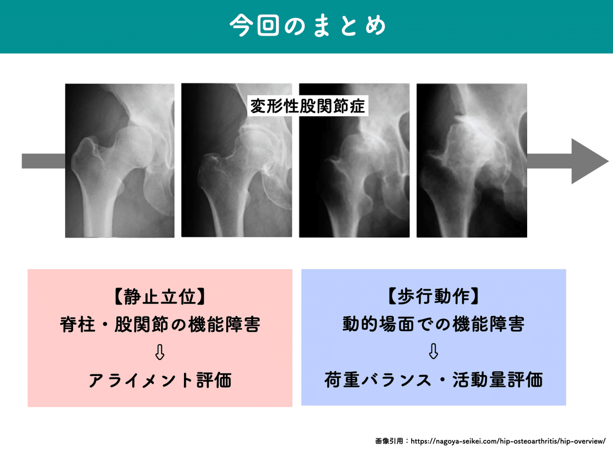 変形性股関節症の評価と治療 変形性股関節症の評価と治療【DVD2枚組】 変形性股関節症の評価